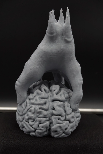 Thumbnail: Stressed Out Brain Statue