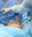 cirurgia minimamente invasiva.webp