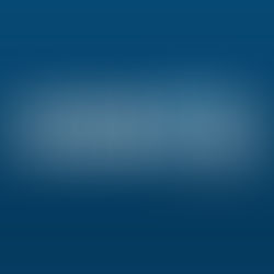 Kosmos Energy Ltd. (KOS)