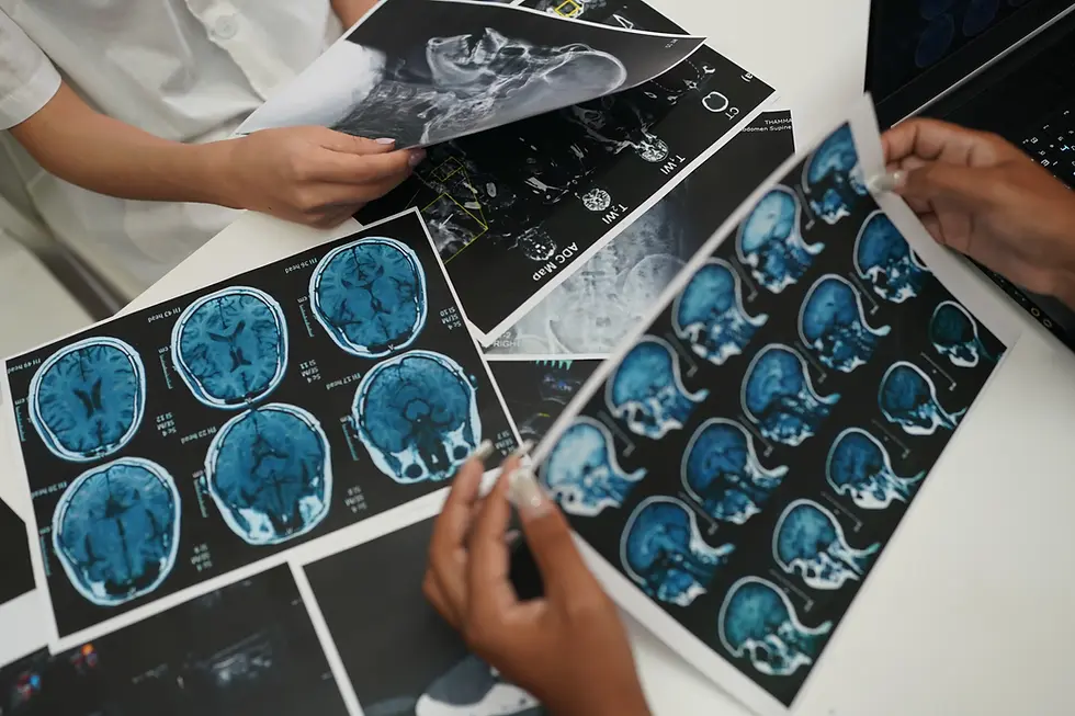 Stroke Mental Health Diagnosis