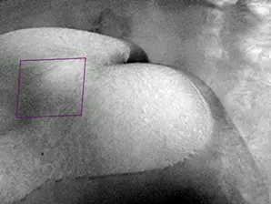 The Big Picture: Understanding Vaginal Examinations in Labour