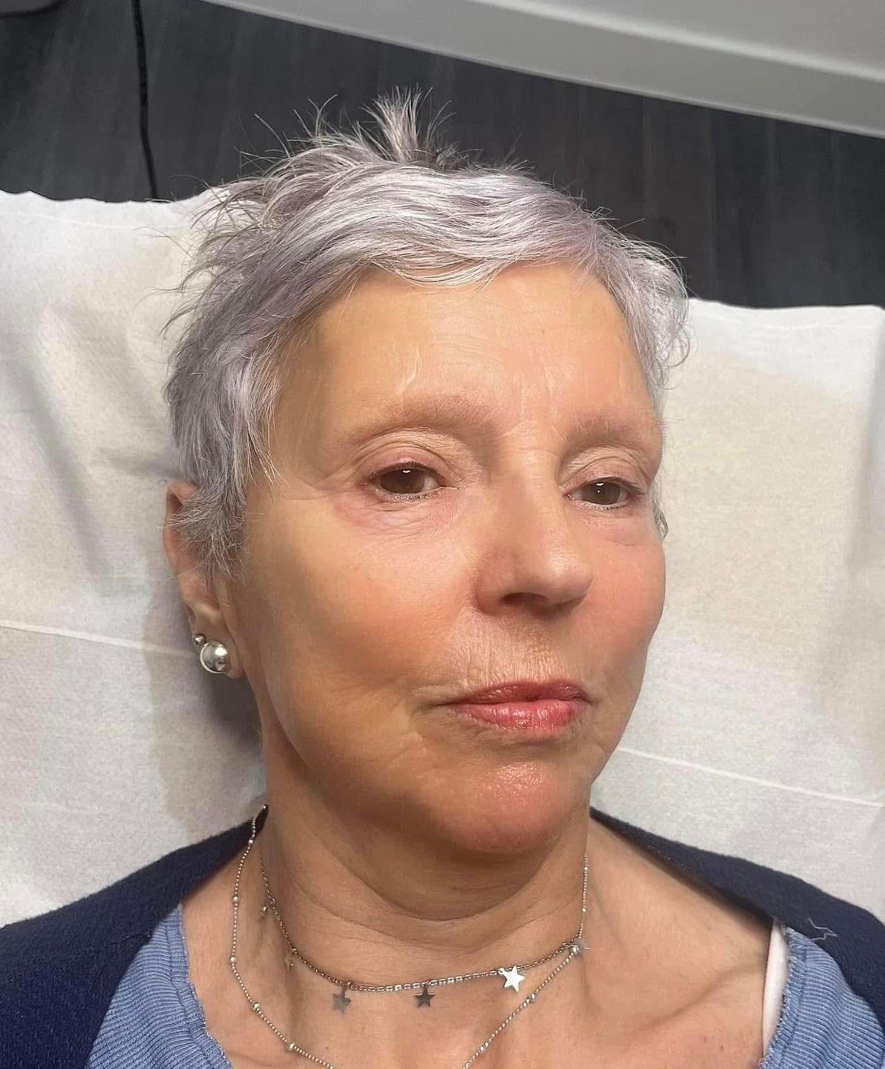 Before treatments.