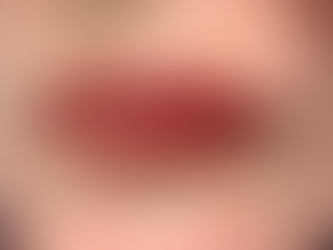 Lip Blush After Facial Trauma: A Journey of Confidence, Healing & Restoring Lip Definition