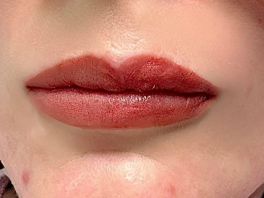 Lip Blush After Facial Trauma: A Journey of Confidence, Healing & Restoring Lip Definition