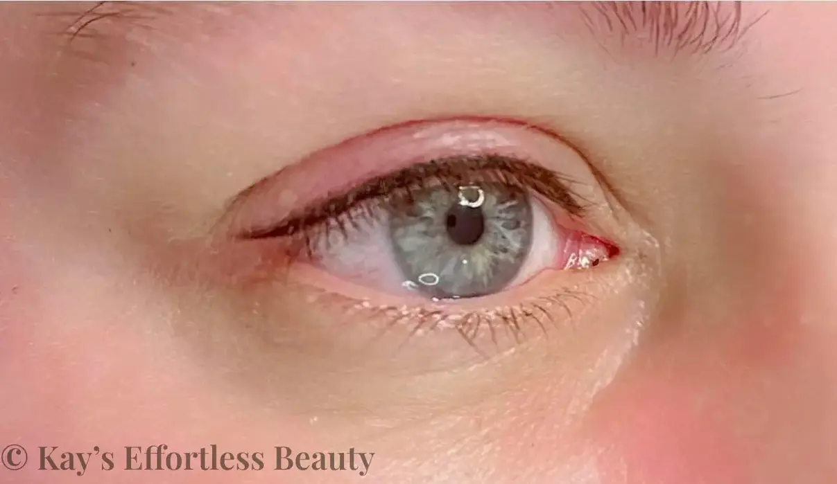 Picture of eyeliner treatment