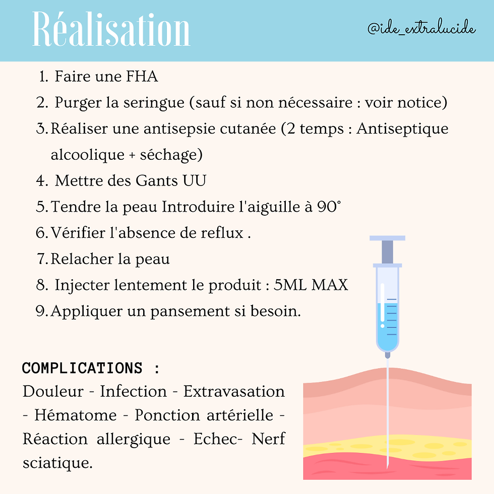 Réalisation d'une IM