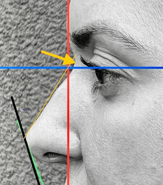 Face assessment before injection.jpg