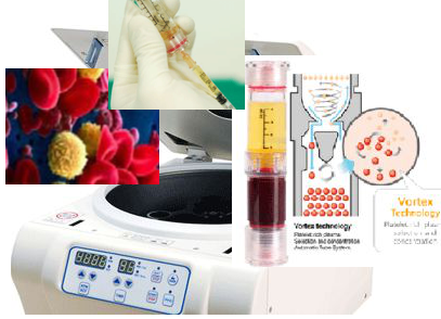 PRP Regenerative treatment used for
