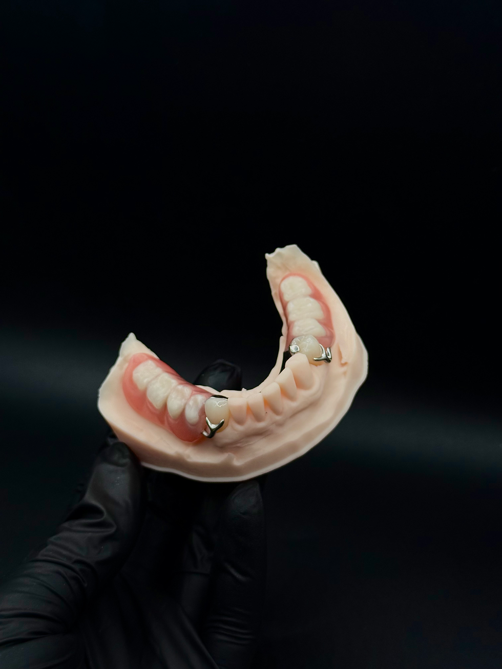 Partial denture on a model for dental lab communication