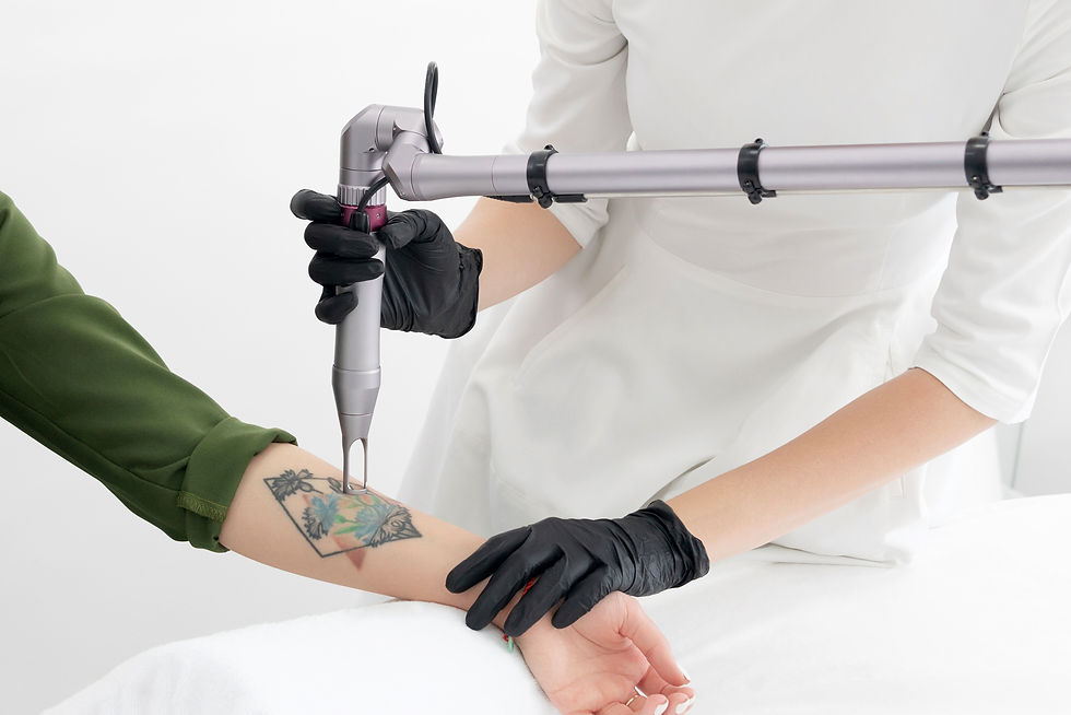 beautician-using-laser-device-remove-unwanted-tattoo-from-female-arm-concept-erasing.jpg