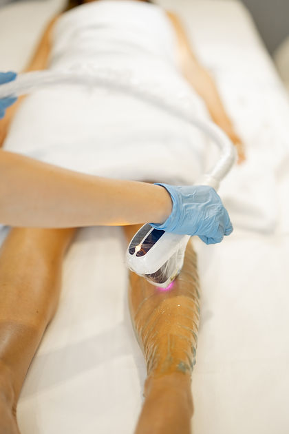 laser-hair-removal-procedure-womans-legs.jpg