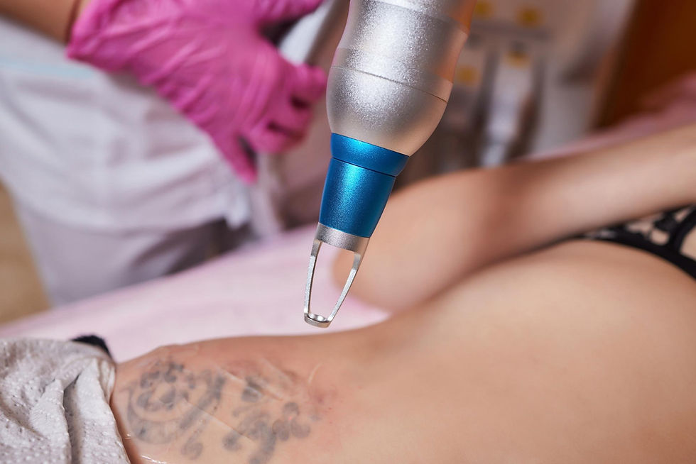 young-woman-undergoing-laser-tattoo-removal-procedure-salon-closeup (1).jpg
