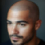 man-with-hair-loss-problem-before-after-treatment.jpg