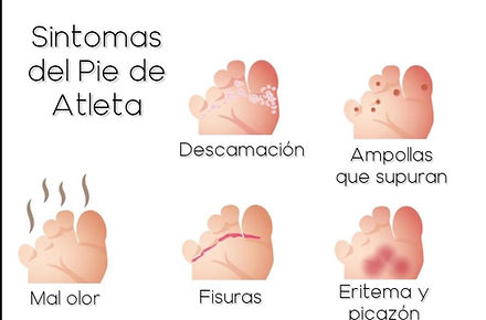 PieDeAtleta.jpg