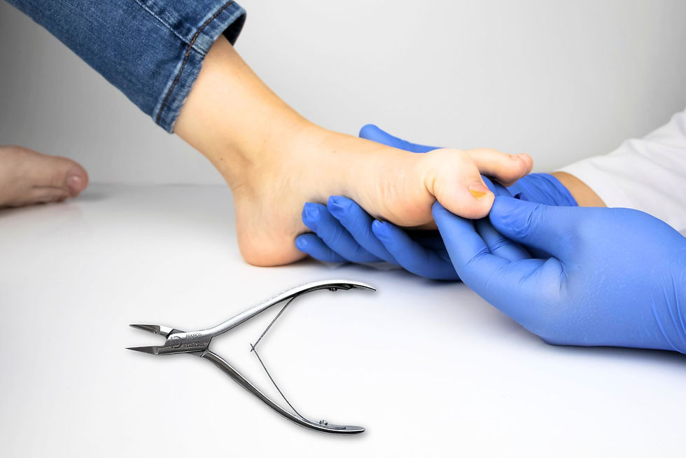 Thumbnail: EX-5000 Bianco Extreme 5" English Anvil Bianco Instruments Podiatry