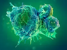 Best Oncology Doctor in Balasore at Medicare