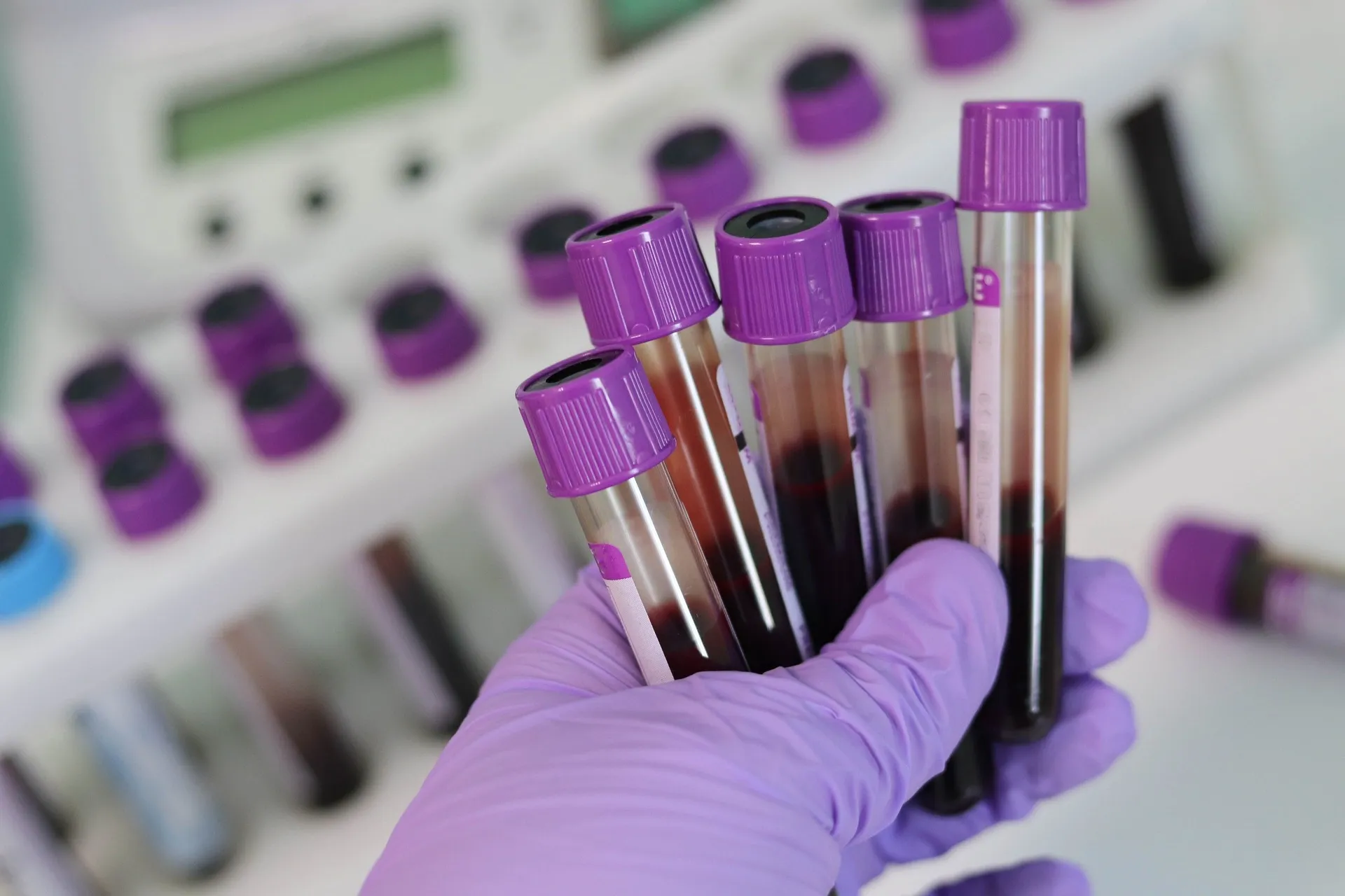 blood samples.webp