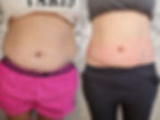 Body Sculpting
