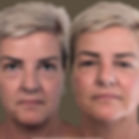 Face Filler