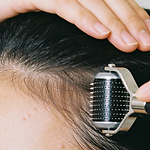 Hair Loss Treatment Derma Rolling