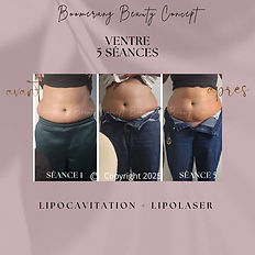 avant/après soin minceur ventre, poignées d'amour