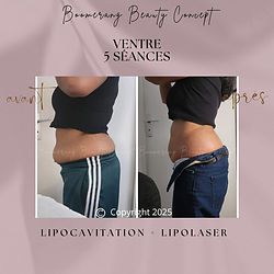 soin minceur avant/après ventre