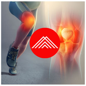 Runner’s Knee