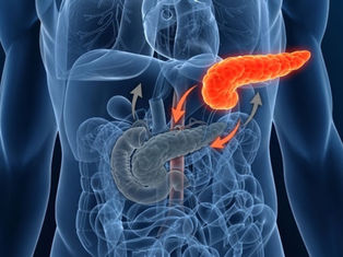 Transplante de pâncreas existe? Cirurgião explica quando o procedimento é indicado