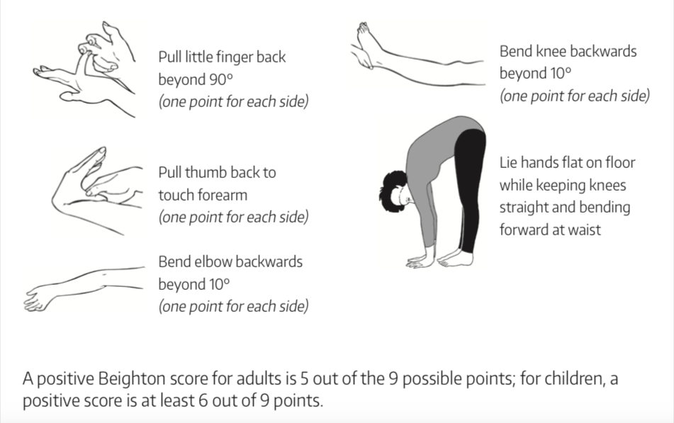 Joint Hypermobility Syndrome Understanding Its Complex Presentation