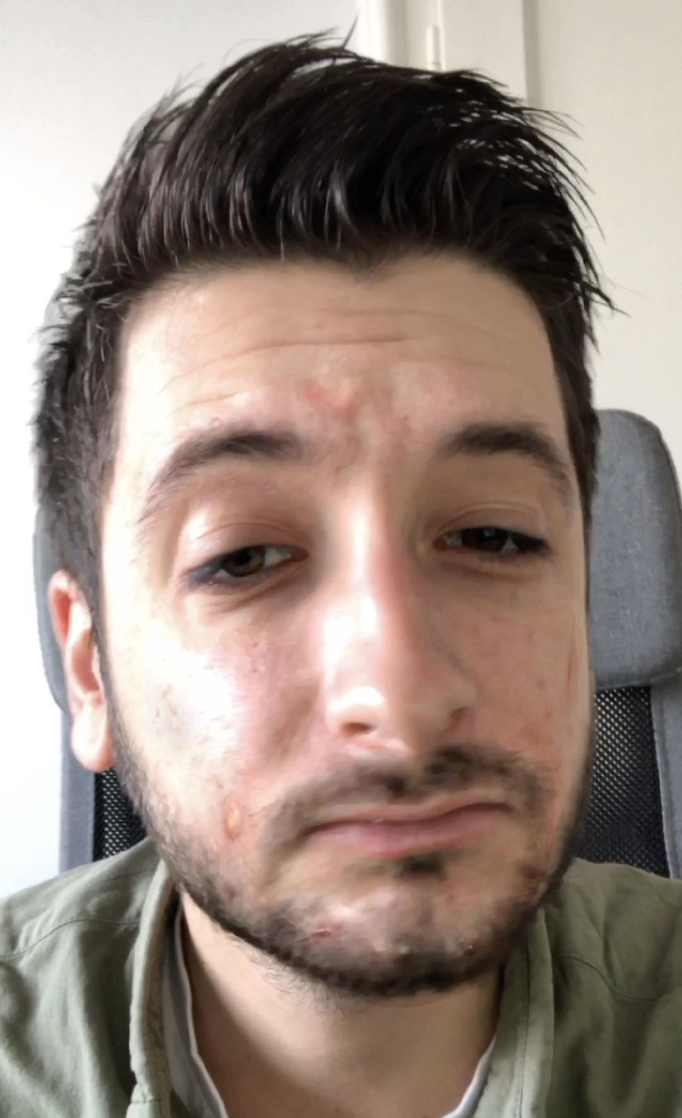 Thumbnail: Puberty