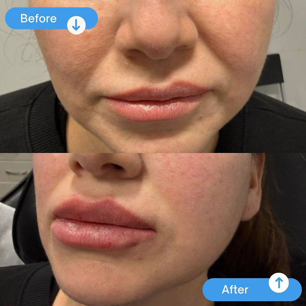 Beige Minimalist Skincare Before and After Instagram Post-2