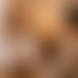 Chequeo médico preventivo en paciente adulto con médico internista en Tehuacán