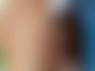 Aplicação do jato de plasma em estrias para estimular a regeneração da pele e a produção de colágeno de forma precisa e controlada.