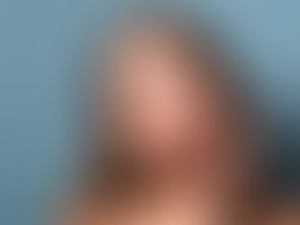 Lifting Facial: Rejuvenescimento com Técnicas Avançadas