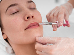 Preenchimento com Ácido Hialurônico: Transforme Sua Pele com Resultados Naturais