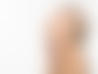 Harmonização Facial Completa: Realce Sua Beleza de Forma Natural