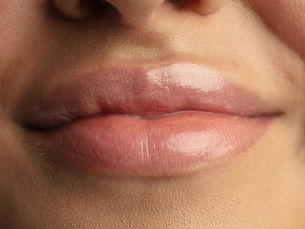 Lábios Radiantes: Cuidados e Tratamentos para Realçar Sua Beleza Natural e Confiança