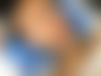 Revitalize seu visual com o preenchimento facial.