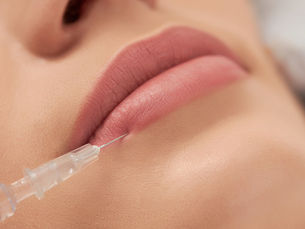 Preenchimento Labial: Realce a Beleza dos Seus Lábios de Forma Natural