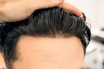 Australian front lace hair patch Pune