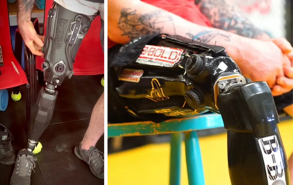 Prótese para membro inferior impressa em 3D