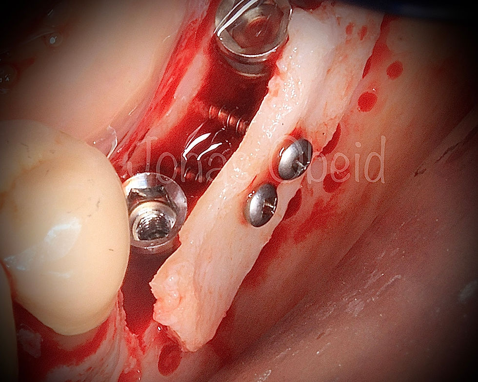 IMG_9453_20210505140131