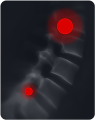 Точки запалення