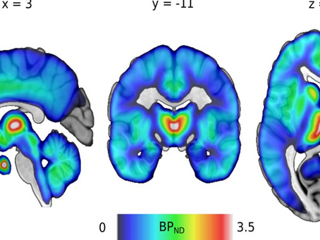 Il cervello oppioide: l’allenamento al benessere