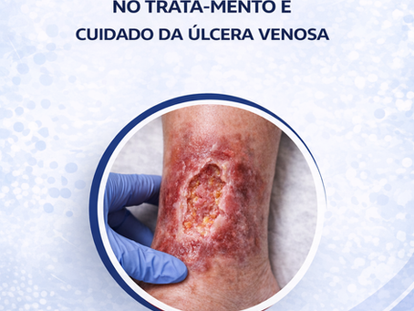 A  Assistência da  Enfermagem no  Tratamento da Úlcera Venosa