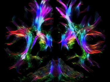Slicing_fiber_tractography_30s.gif