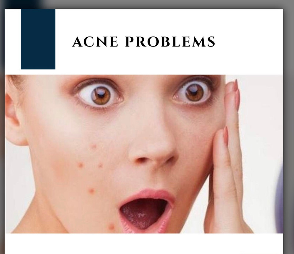 Acne