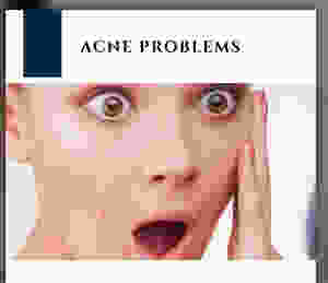 Acne
