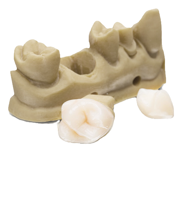 Definitive Restorations