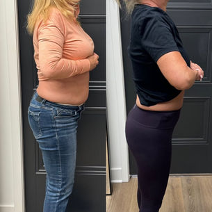 Side-by-side progress photo showing a patient’s body profile changes during an Omaha weight loss program.
